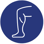 Limb Deformities